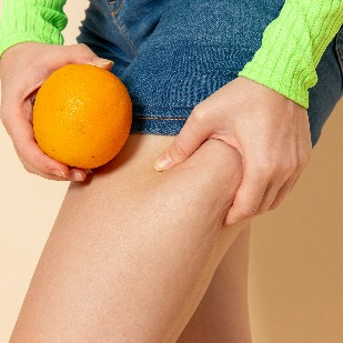 What is the Best Cellulite Reduction?