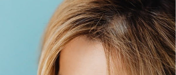 Can Red Light Therapy Help With Alopecia Areata?